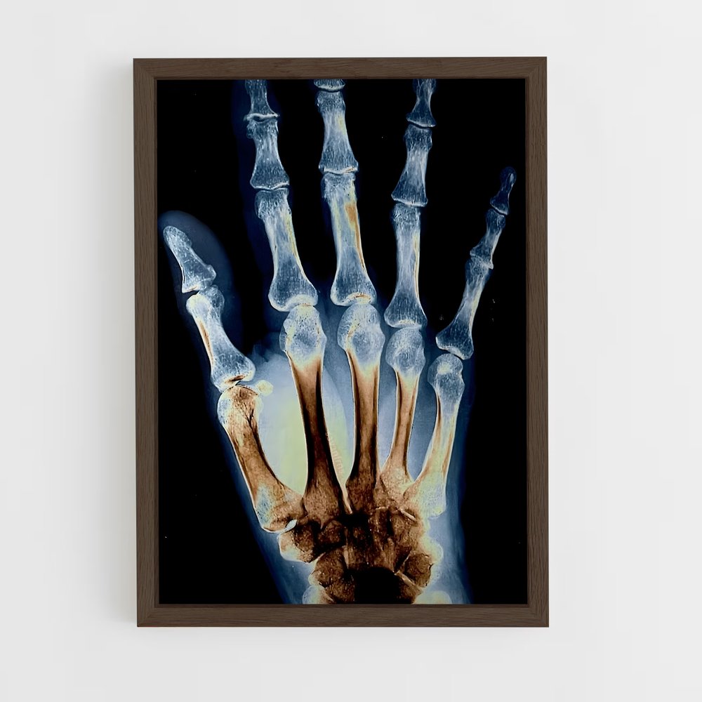 ap-x-rays-2 cadre Bois foncé