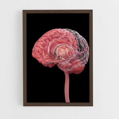 ap-brain anatomy-1 cadre Bois foncé