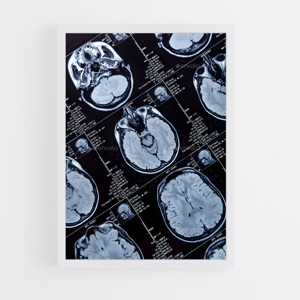 ap-brain scan-1 cadre Blanc