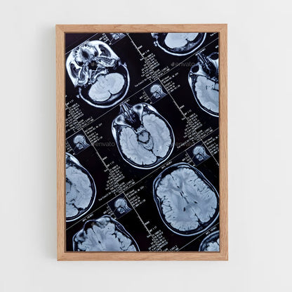 ap-brain scan-1 cadre Bois clair