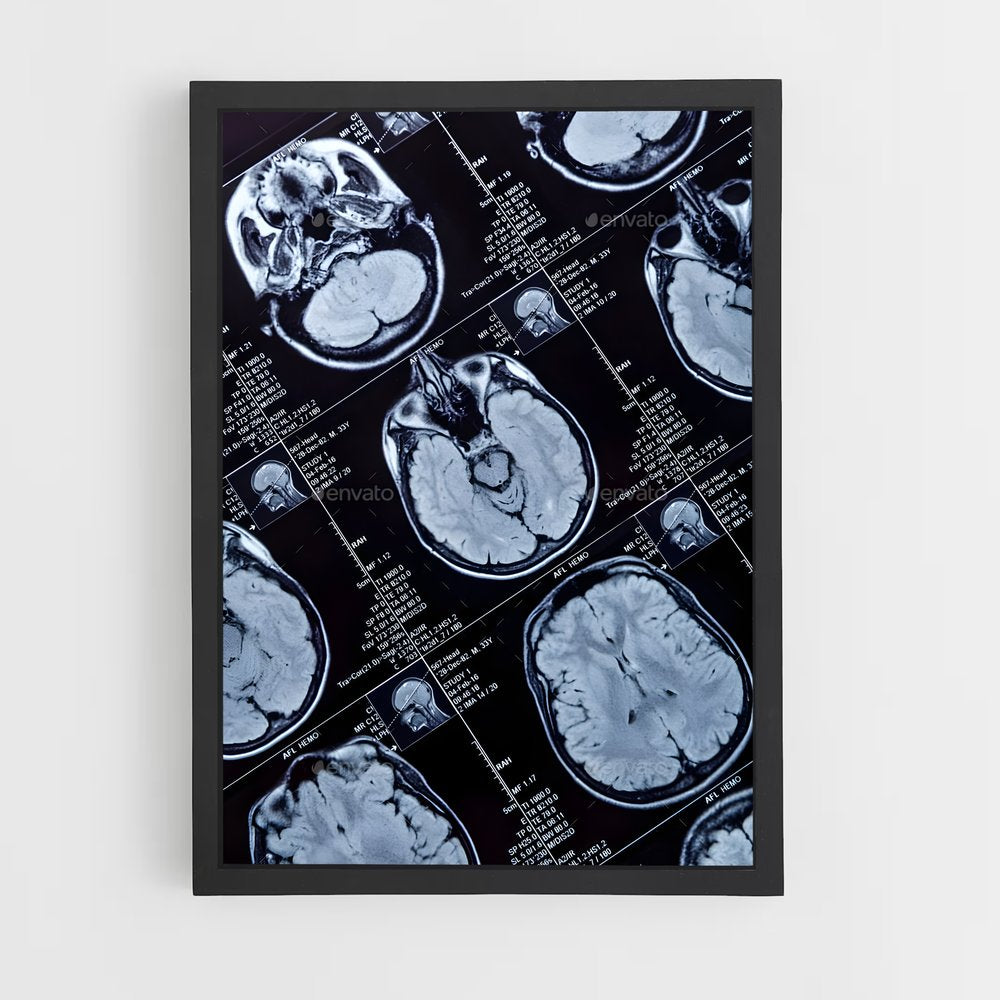 ap-brain scan-1 cadre Noir