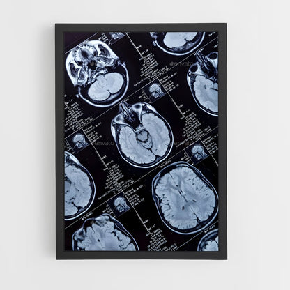 ap-brain scan-1 cadre Noir