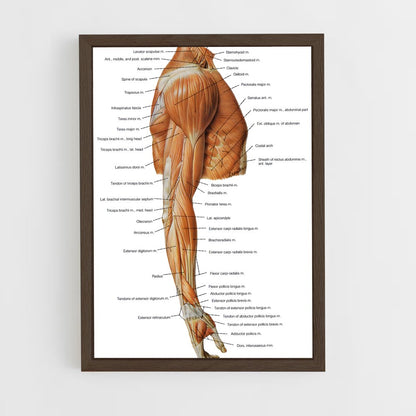 ap-muscle-5 cadre Bois foncé