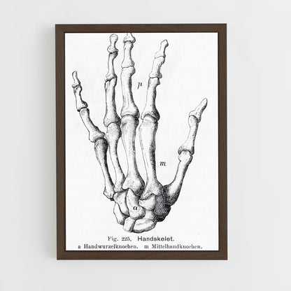 ap-palm-2 cadre Bois foncé