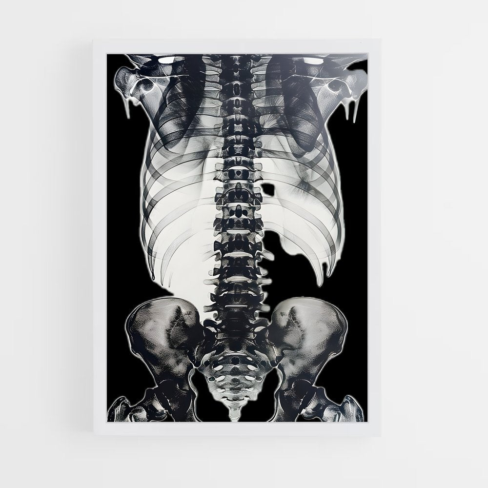 ap-skeleton-5 cadre Blanc