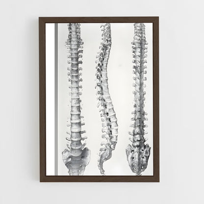ap-spine-11 cadre Bois foncé