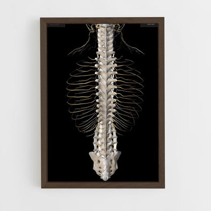 ap-spine-6 cadre Bois foncé