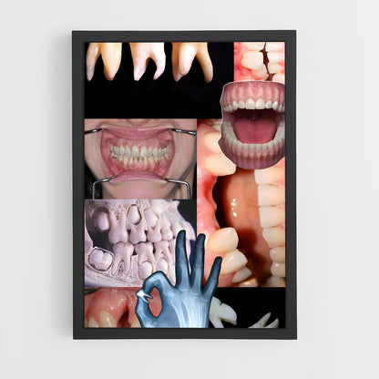 ap-teeth-2 cadre Noir
