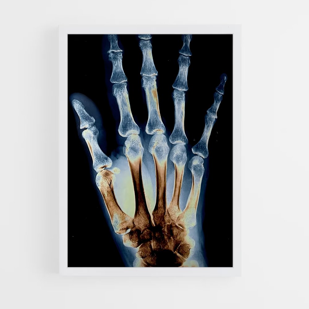 ap-x-rays-2 cadre Blanc