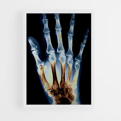 ap-x-rays-2 cadre Blanc
