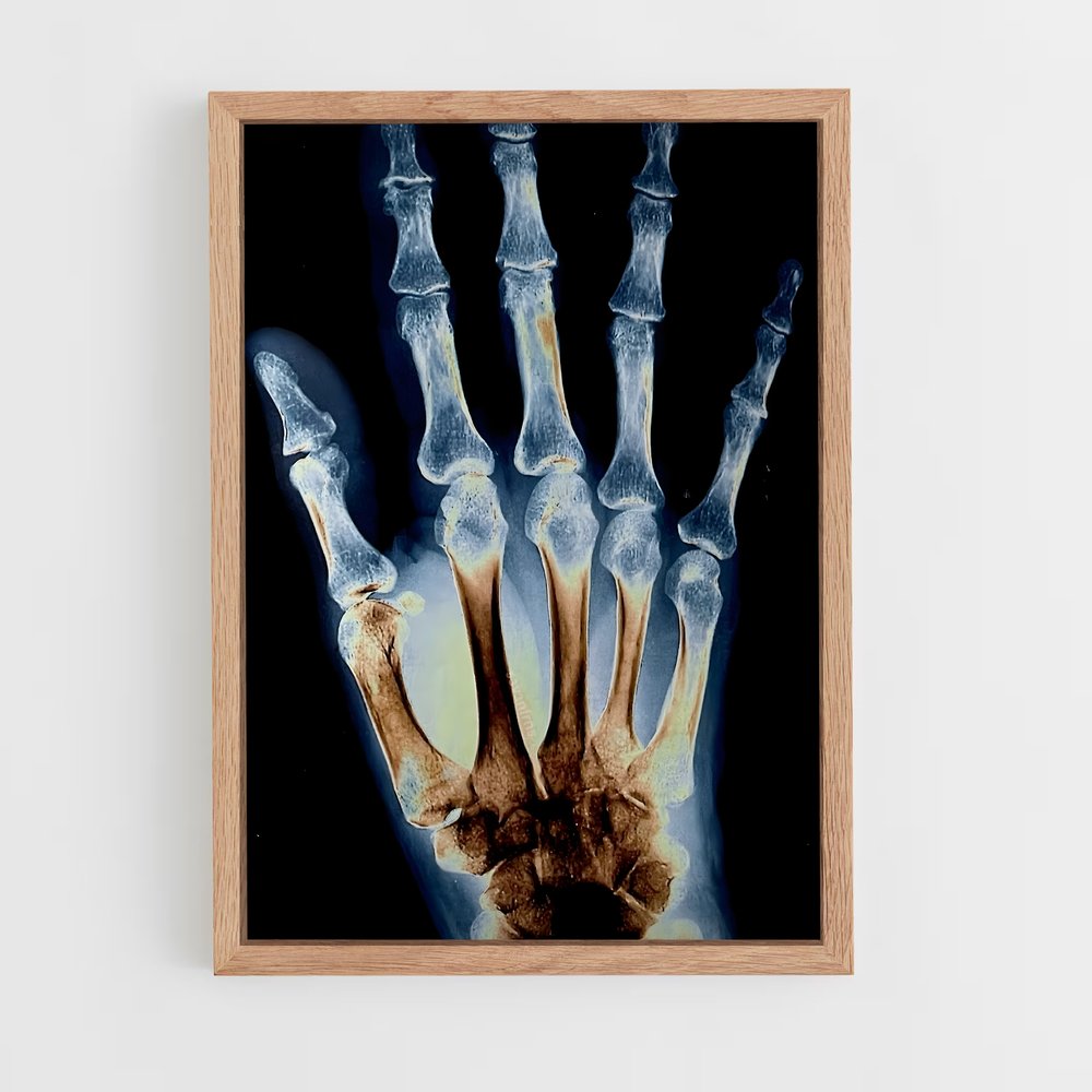 ap-x-rays-2 cadre Bois clair