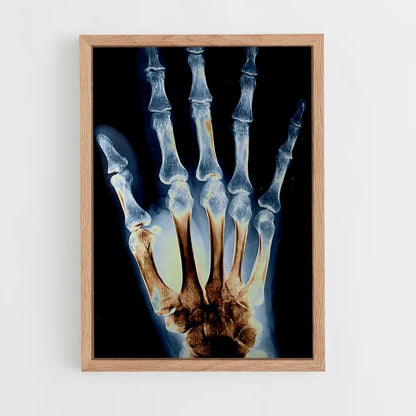 ap-x-rays-2 cadre Bois clair