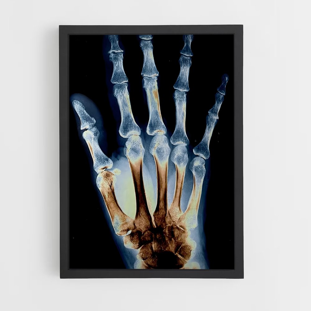 ap-x-rays-2 cadre Noir