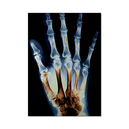 Poster Fracture Mystique