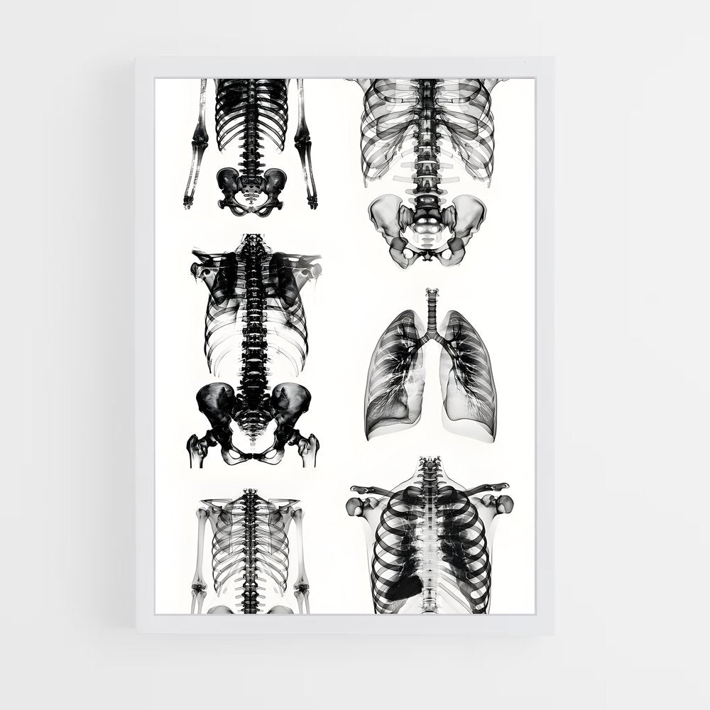 ap-x-rays-3 cadre Blanc