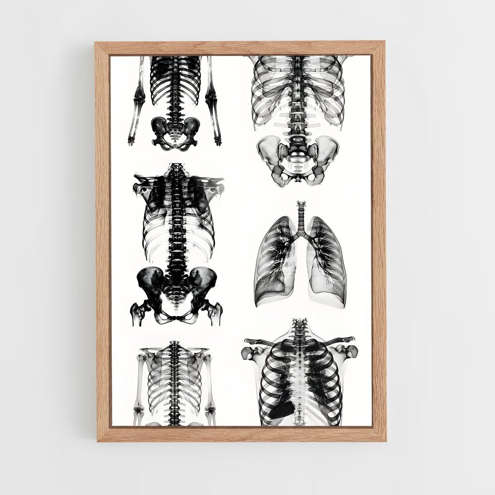 ap-x-rays-3 cadre Bois clair