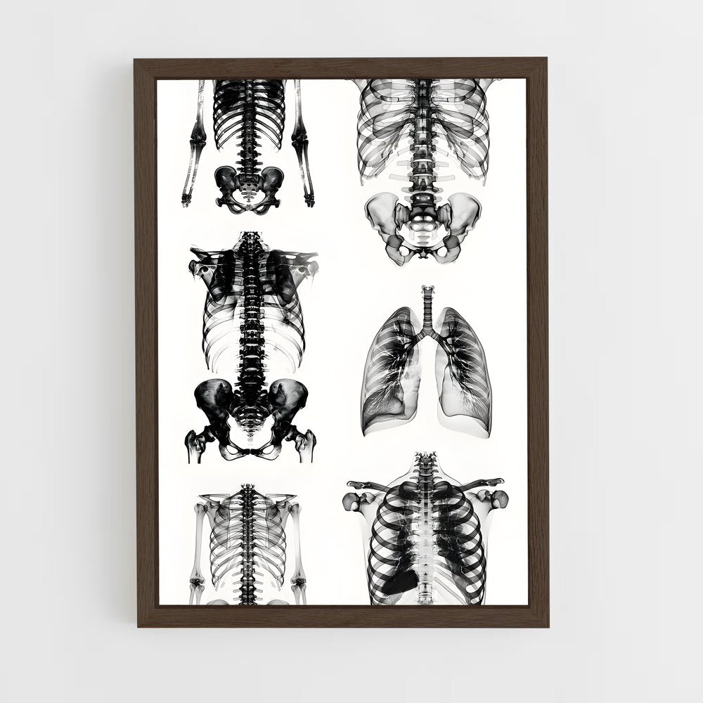 ap-x-rays-3 cadre Bois foncé