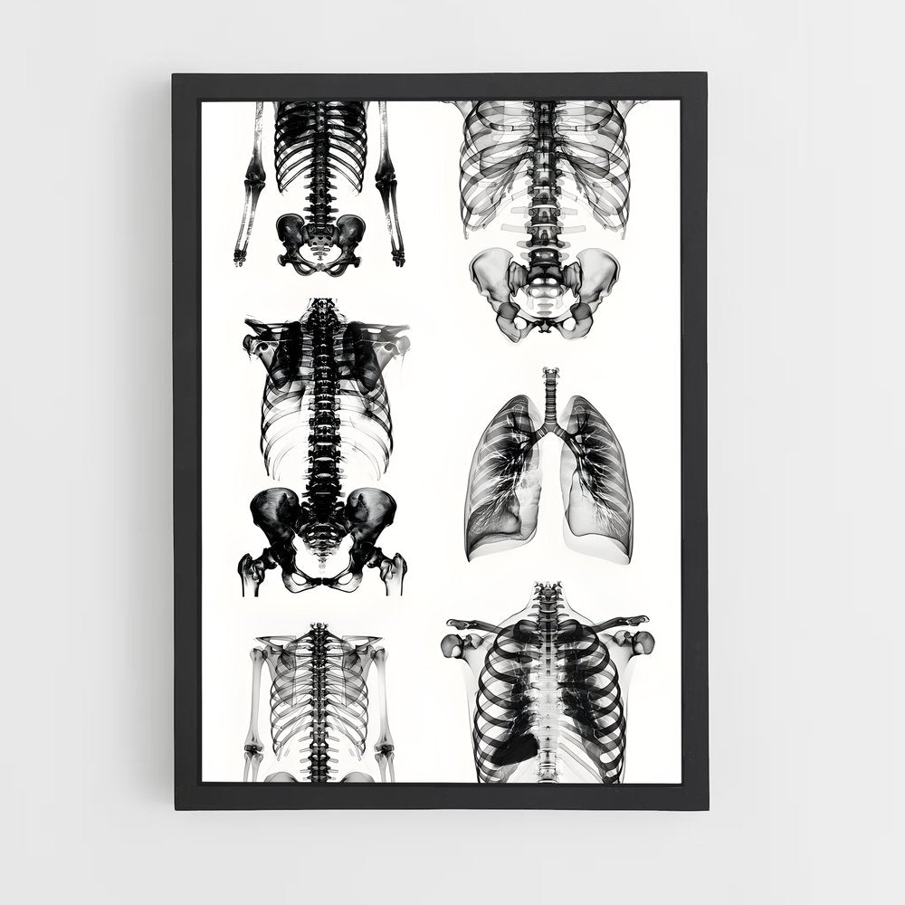ap-x-rays-3 cadre Noir