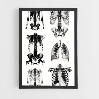 ap-x-rays-3 cadre Noir