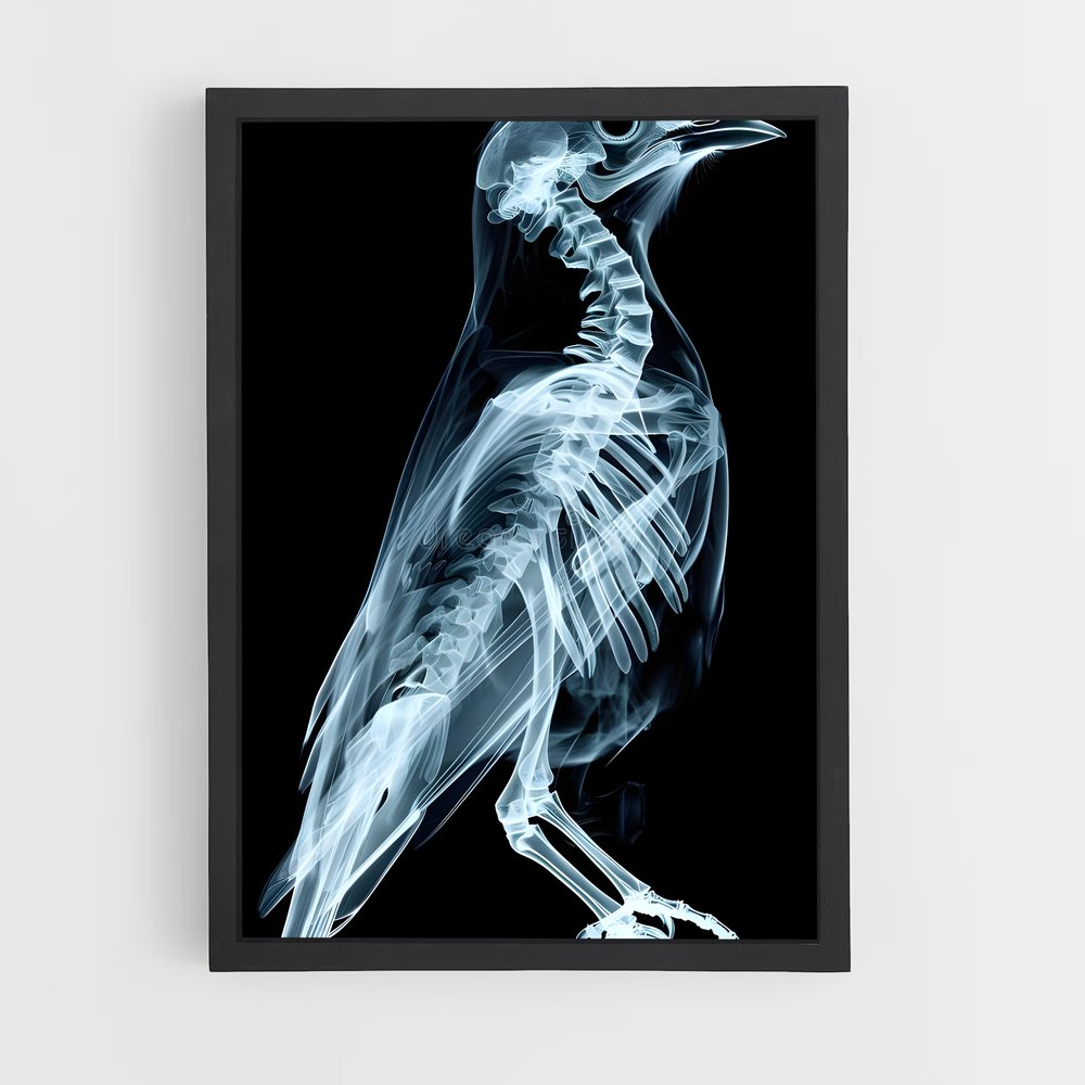 ap-x-rays-5 cadre Noir